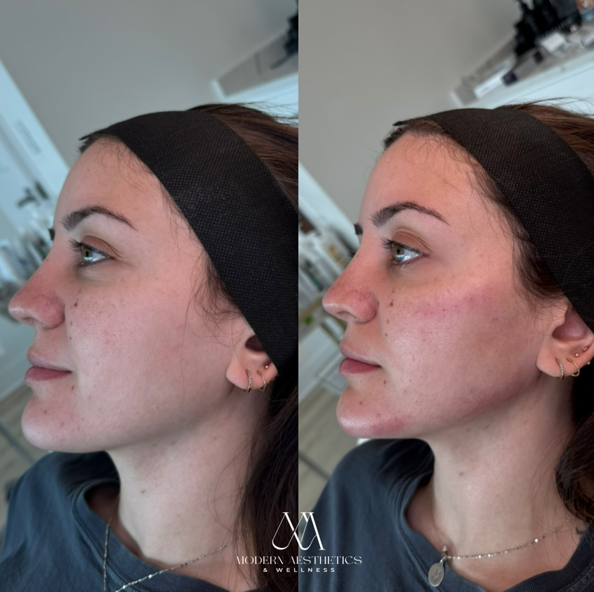 FacialBalancing Result