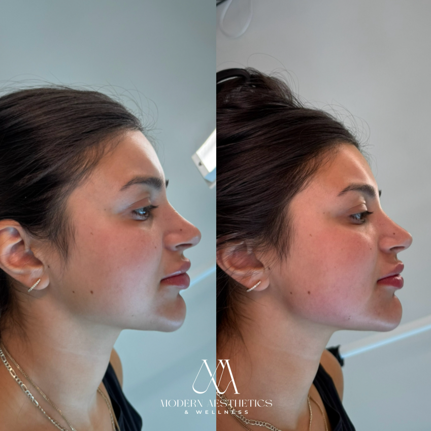 FacialBalancing Result