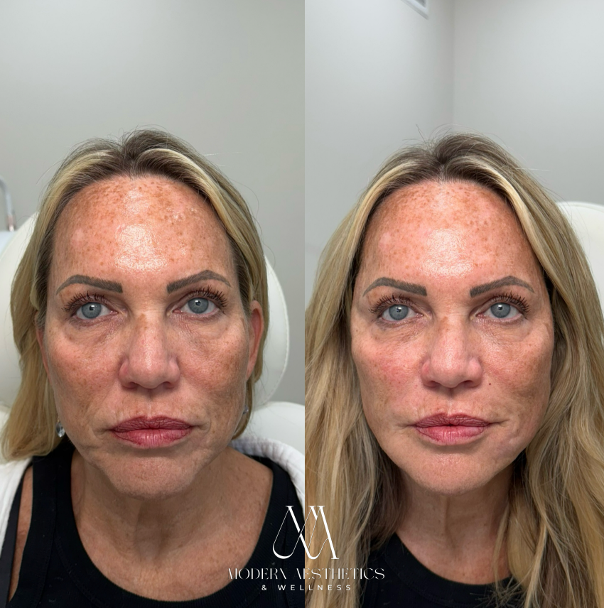 FacialBalancing Result