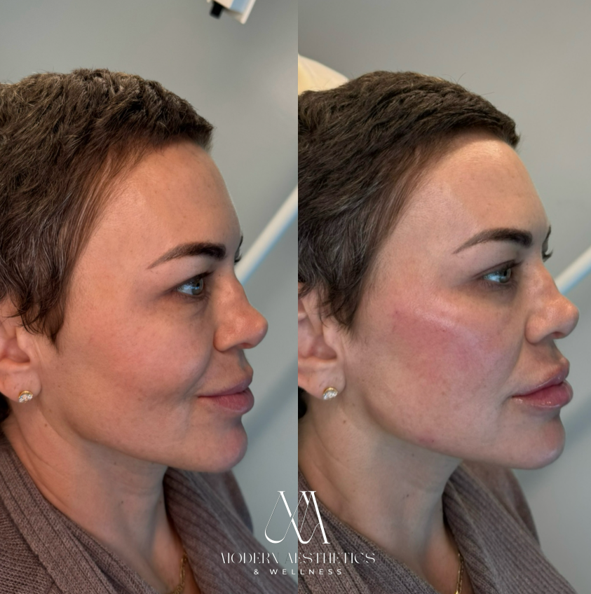 FacialBalancing Result