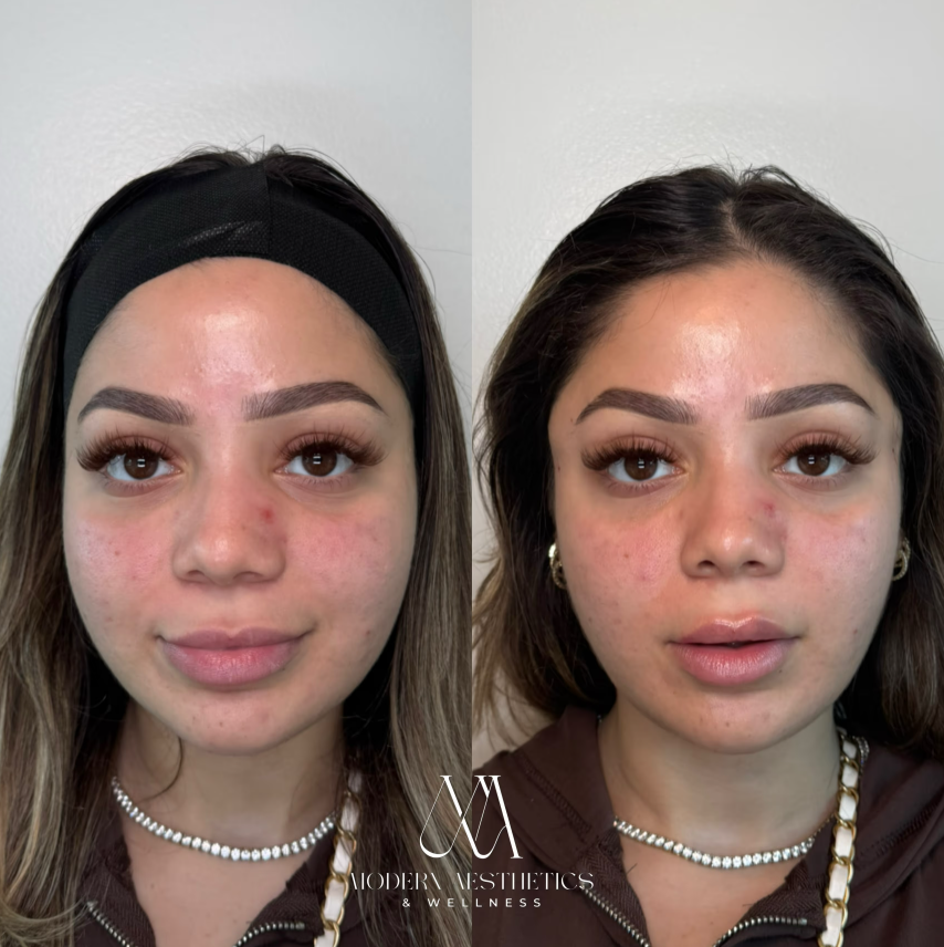 PDOThreadLifting Result