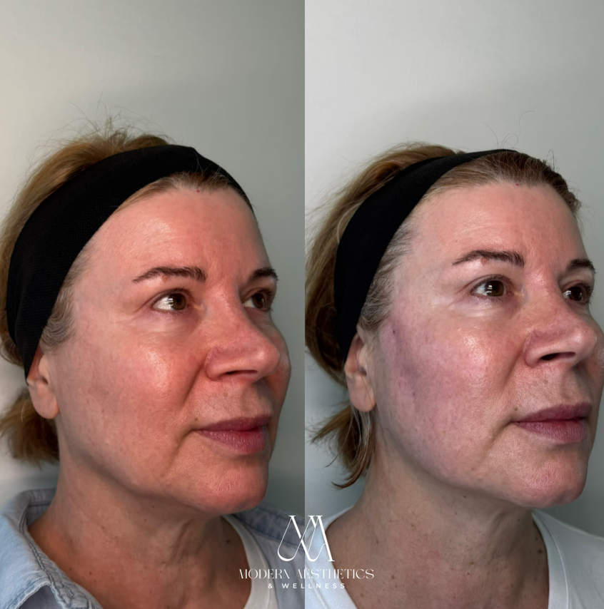 PDOThreadLifting Result